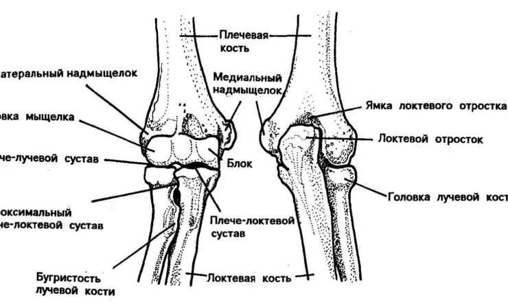 Причины, симптомы и лечение артроза локтевого сустава