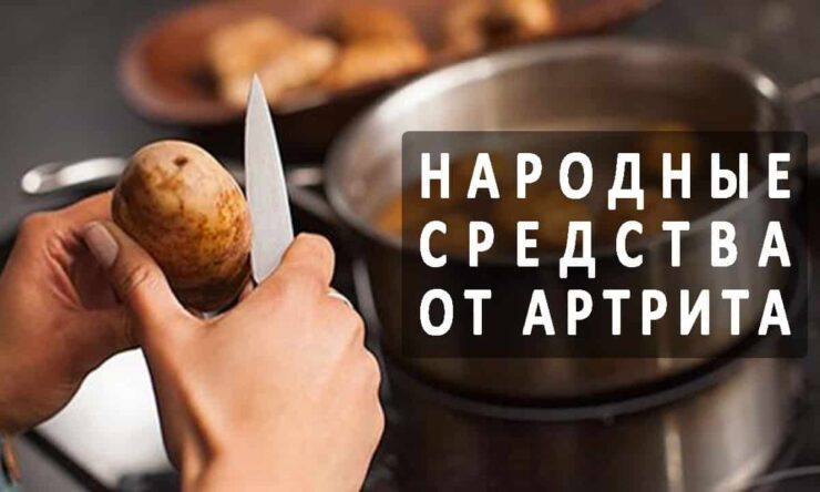 Действенное лечение артрита народными средствами