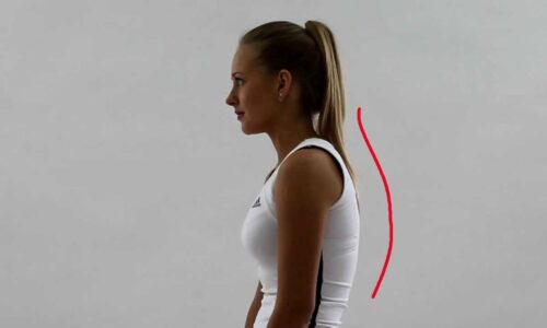 Причины и лечение сколиоза 1 степени